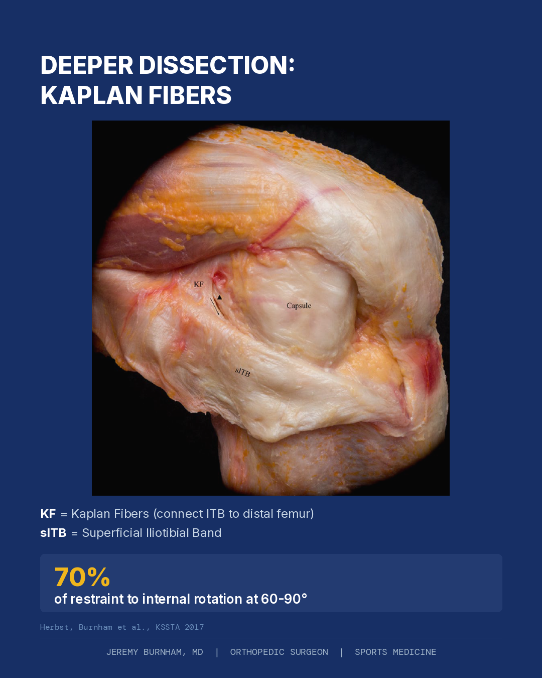 Anatomy Diagram Of The Anterolateral Complex Showing Superficial Itb Layer Kaplan Fibers And Capsular Restraints With Percentage Contributions To Internal Rotation Restraint At Sixty To Ninety Degrees Flexion