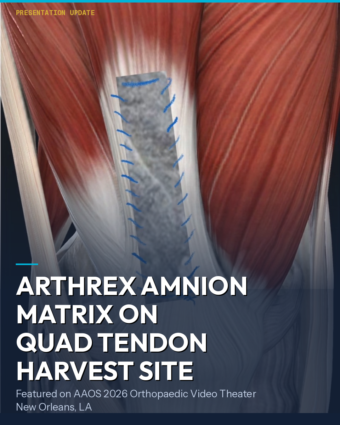 Arthrex Amnion Matrix On Quad Tendon Harvest Site Presentation Update Cover Slide From Aaos 2026